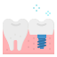 Dental-Treatment